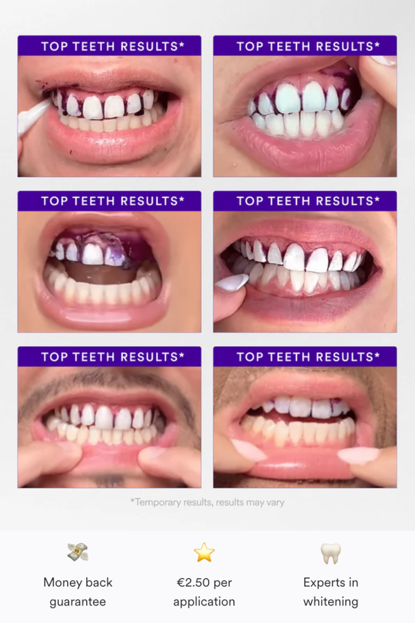 V34 Whitening Strips - Buy 1, Get 1 FREE