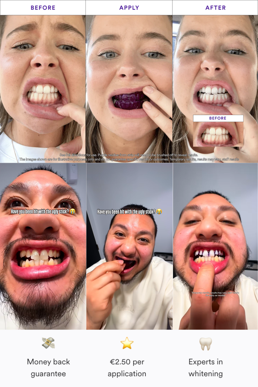 V34 Whitening Strips - Buy 1, Get 1 FREE