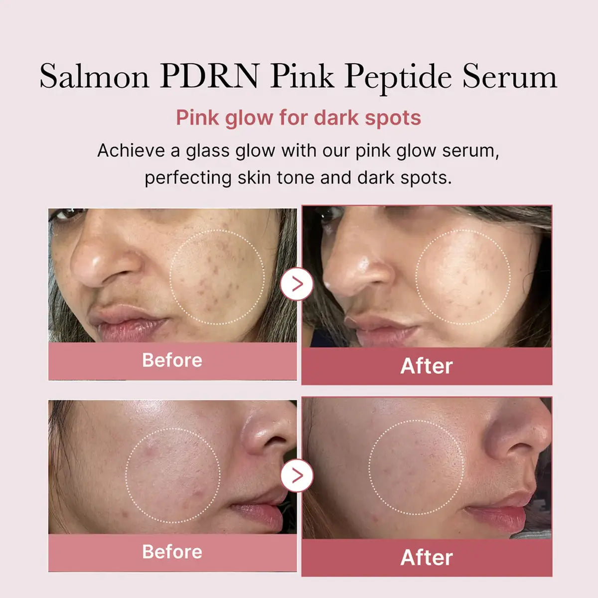 Medicube PDRN Pink Peptide Glow Serum 30mL